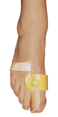 806030.jpg Hallux-Valgus Night,Schiene f.,die Nacht,rechts,