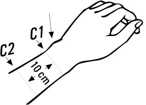 Bort ManuBasic Handgelenk-,Bandage links schwarz Gr.L,